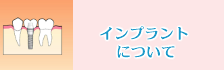 インプラントについて
